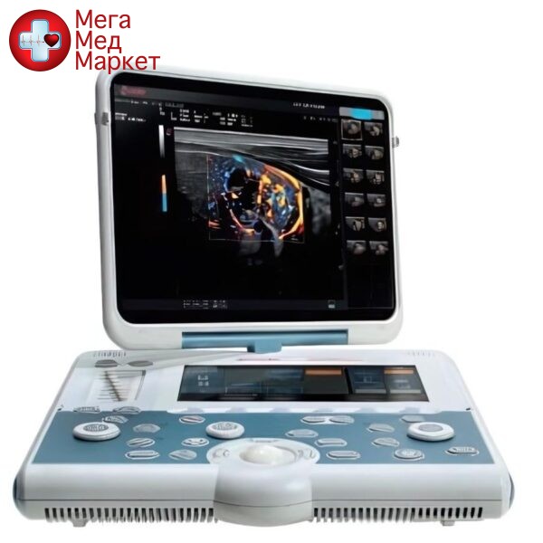 Ультразвуковой аппарат MyLab Gamma
