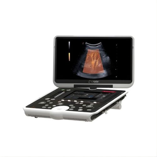 Портативный ультразвуковой аппарат MyLab Omega eXP