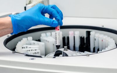 Обладнання для біохімічної діагностики: на що звертати увагу?