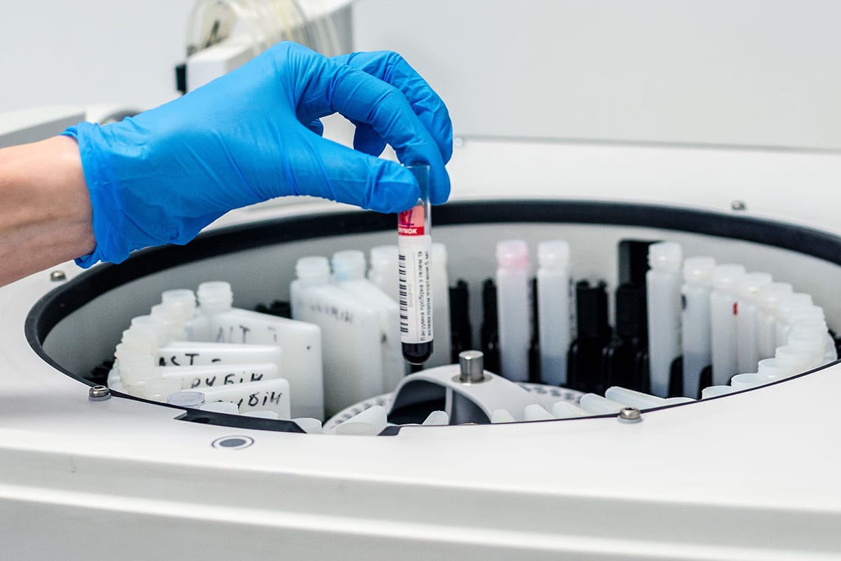 Обладнання для біохімічної діагностики: на що звертати увагу? Обладнання для біохімічної діагностики: на що звертати увагу?