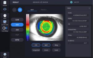 Роговичный топограф с анализом сухого глаза HTG-1 Huvitz