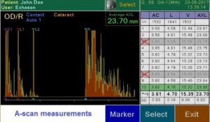 Ультразвуковой офтальмологический сканер Echoson PIROP