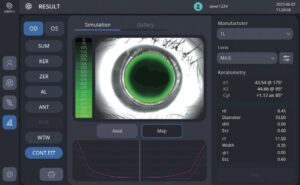 Оптический биометр и роговичный топограф HBM-1 Huvitz