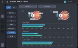 Оптический биометр и роговичный топограф HBM-1 Huvitz