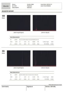 Оптический биометр и роговичный топограф HBM-1 Huvitz