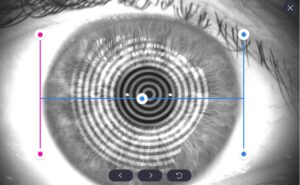 Роговичный топограф с анализом сухого глаза HTG-1 Huvitz