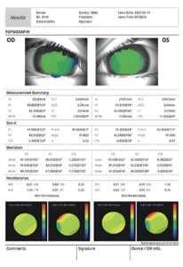 Оптический биометр и роговичный топограф HBM-1 Huvitz
