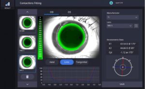 Роговичный топограф с анализом сухого глаза HTG-1 Huvitz