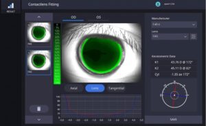 Роговичный топограф с анализом сухого глаза HTG-1 Huvitz