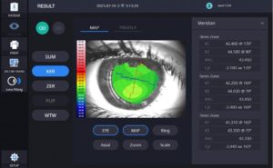 Роговичный топограф с анализом сухого глаза HTG-1 Huvitz