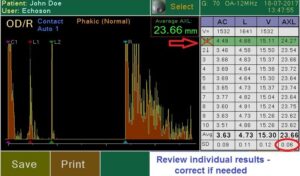 Ультразвуковой офтальмологический сканер Echoson PIROP