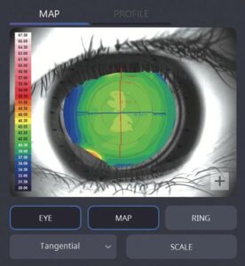 Роговичный топограф с анализом сухого глаза HTG-1 Huvitz