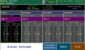 Ультразвуковой офтальмологический сканер Echoson PIROP