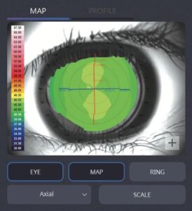 Роговичный топограф с анализом сухого глаза HTG-1 Huvitz