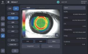 Оптический биометр и роговичный топограф HBM-1 Huvitz