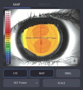 Роговичный топограф с анализом сухого глаза HTG-1 Huvitz