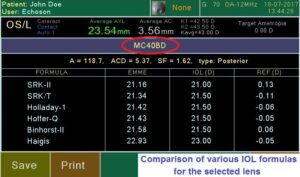 Ультразвуковой офтальмологический сканер Echoson PIROP