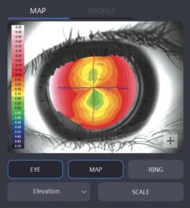 Роговичный топограф с анализом сухого глаза HTG-1 Huvitz