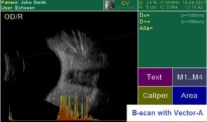 Ультразвуковой офтальмологический сканер Echoson PIROP