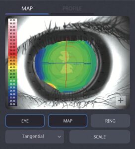 Оптический биометр и роговичный топограф HBM-1 Huvitz
