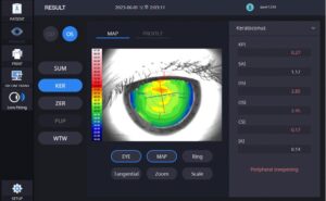 Роговичный топограф с анализом сухого глаза HTG-1 Huvitz