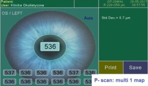 Ультразвуковой офтальмологический сканер Echoson PIROP