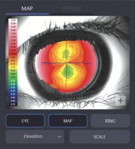 Оптический биометр и роговичный топограф HBM-1 Huvitz