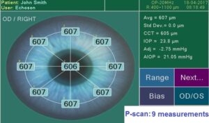 Ультразвуковой офтальмологический сканер Echoson PIROP