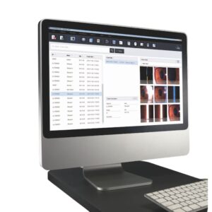 Цифровая камера HIS-5000 Huvitz