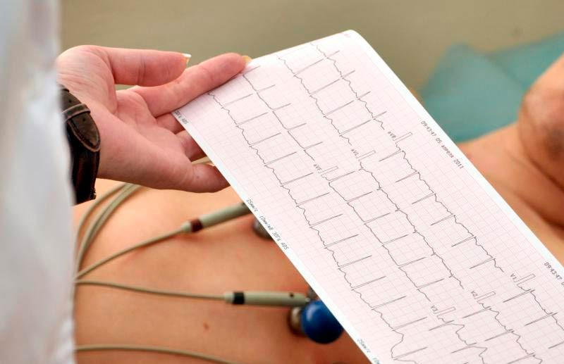 Як вибрати ЕКГ-апарат для кабінету кардіолога