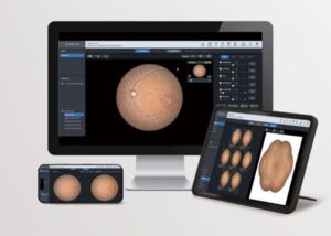 Немидриатичная фундус камера HFC-1 Huvitz