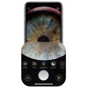 Оптическая система Custom Surgical MicroREC