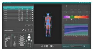 Денситометр рентгеновский полноформатный костный Density PB Eurotec Medical System