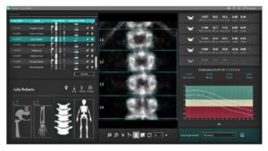 Денситометр рентгеновский полноформатный костный Density PB Eurotec Medical System