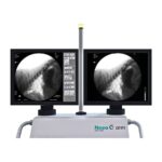 Мобильная цифровая рентгенографическая система С-дуга Neeo C-Arm R9 Ibis
