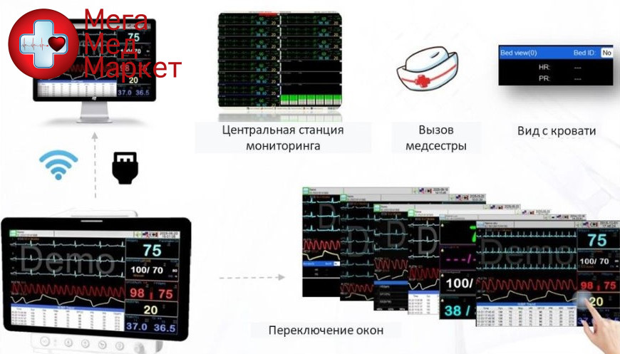 Монитор пациента F6 A10+93 17.3“ с модулем EtCO2